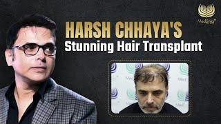 Harsh Chhaya’s Stunning Hair Transplant!! | Celebrity Hair Goals! | MedLink