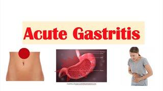 Acute Gastritis (Stomach Inflammation) | Causes, Signs & Symptoms, Diagnosis, Treatment