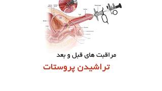 مراقبت های قبل و بعد جراحی پروستات _ دکتر میرصادقی