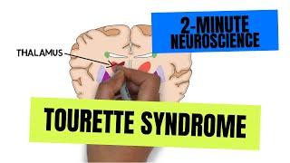 2-Minute Neuroscience: Tourette Syndrome