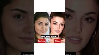 Hande Ercel Before After  #handeerçel #shorts #viral