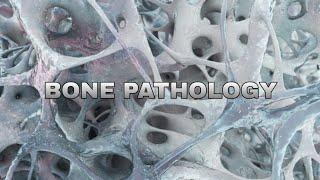 Bone pathology 2nd lecture