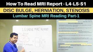 How to read MRI Report, Lumbar Spine MRI-L4-L5-S1 MRI for low back pain, Sciatica,Herniated Disc MRI