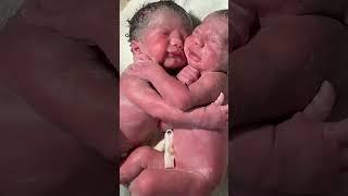 Twin birth #junior #shorts #baby #twins #babygirl