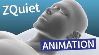 ZQuiet Mandibular Advancement Device – Animation