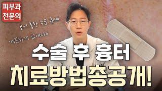 [수술 후 흉터] 수술 하고 남은 수술흉터 이제는 안 가려도 된다!!