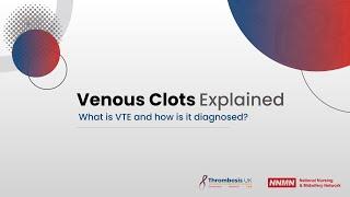 What is VTE and how is it diagnosed?