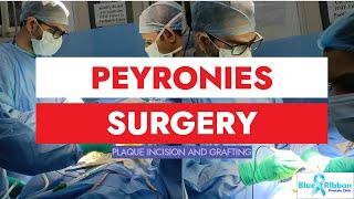 Peyronies Disease And Diabetes Type 2 | Live surgery Plaque incision and grafting (PIG)