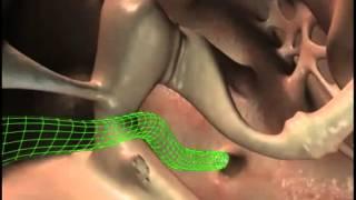 How Humans Hear - Mechanism Of Action - illustration