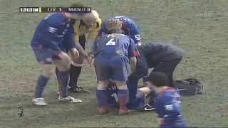 Alan Smith vs John Arne Riise's free kick - The terrible injury ruined his career