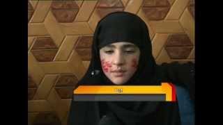 Kabul girl miracle, Allah and Muhammad (s.a.w) names on face, Wagma