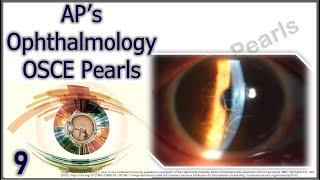 AP's Ophthalmology OSCE Pearls 9