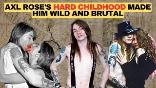 Axl Rose : His Volatality Could Cause Real Destruction, His Romantic Life Was More Guns Than Roses