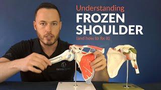 Understanding FROZEN SHOULDER and how to stretch for greater movement