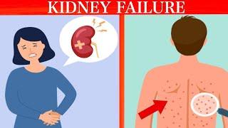 Signs Your Kidneys Need Help: How to Take Care of Your Kidneys