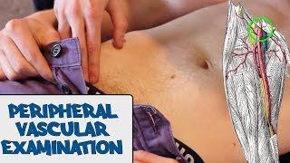 Peripheral Vascular Examination - OSCE Guide (old version) | UKMLA | CPSA | PLAB 2