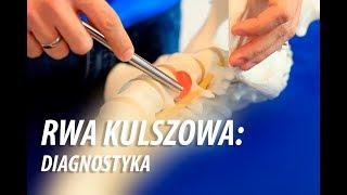 Rwa Kulszowa: Diagnostyka