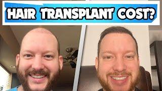 Hair Transplant Cost? Average cost of a hair transplant in the USA