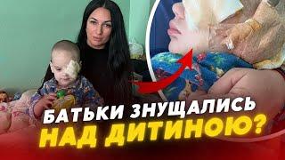 Батьки були п’яні ️ 2-річній дитині ВИКОЛИЛИ ОКО і ВІДКУСИЛИ ВУХО на Рівненщині