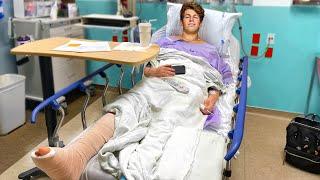 I Broke My Leg... (not a prank)