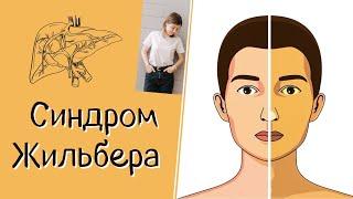 Синдром Жильбера