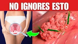 ️ SÍNTOMAS SILENCIOSOS de CANCER de COLON que NO debes IGNORAR