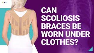 Can Scoliosis Braces Be Worn Under Clothes?