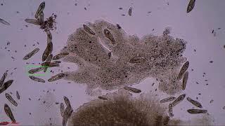 Paramecium tracking test with multiple collisions - MOSSE tracker 1080p