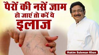 पैरों की नसें जाम हो जाएं तो करें ये इलाज | Hakim Suleman Khan | Sadhna TV