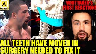 New details revealed of Robert Whittaker's SHATTERED JAW by Khamzat Chimaev's choke,Ilia Topuria,UFC