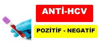 ANTİ-HCV POZİTİF ve NEGATİF NE DEMEK ?