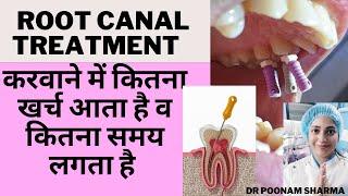 Root Canal Treatment में कितना खर्च व समय लगता है | Root Canal Treatment (RCT) Cost In India