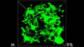 The Brain's Early Response to Concussion