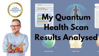 My Quantum Health Scan Results Analysed - 9th July 2024