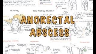 Anorectal Abscess (General Surgery) - Overview