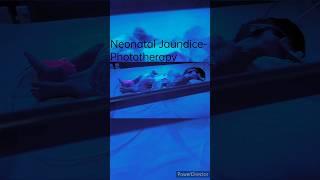 Neonatal Jaundice- Phototherapy
