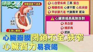 心臟4個瓣膜！閉鎖不全.狹窄 心臟費力易衰竭 健康2.0