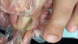 Toenail ASMR and Pedicure DIY Toenail ASMR and Pedicure DIY 486