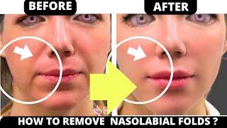 HOW TO GET RID OF NASOLABIAL FOLDS WITH FACE YOGA ? LAUGH LINES / SMILE LINES | NATURALLY