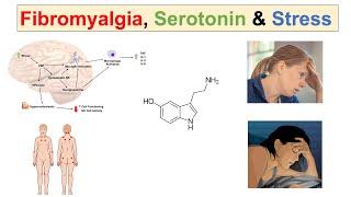 Fibromyalgia, Serotonin & Stress | 5-HTP, Decreased Serotonin and Worsening Fibromyalgia Symptoms