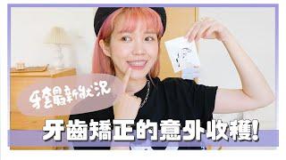 牙套日記！近2年的變化？矯正前必看Q&A｜居妮Ginny Daily