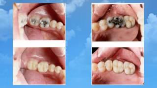 Cosmetic Orthodontics | Lincolnwood, IL – Saul Legator DDS