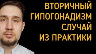 Лечение вторичного гипогонадизма кломифеном. Клинический случай. #кломифен