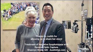 "How to get rid of the shadow that I see after cataract surgery." Treatment of Negative Dysphotopsia