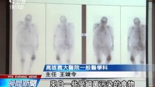 20140514公視晚間新聞－大腸桿菌高抗藥性 入侵人體關節奪命