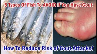 5 Types Of Fish To AVOID If You Have Gout | Reduce Risk of Gout Attacks!