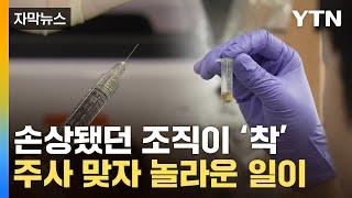 [자막뉴스] 극심한 신체 손상도 원상복구...엄청난 ’신소재‘ 개발 / YTN