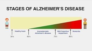 Diagnosing Alzheimer’s Disease