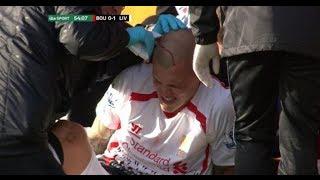 Hard-man | Martin Škrtel has his head stapled back together