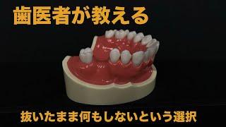 Choice to do nothing with tooth extraction